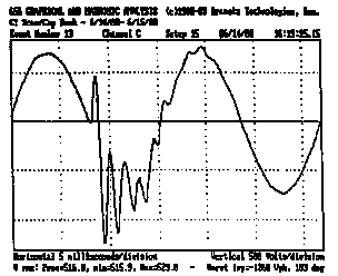 Dranetz Case Study - Utility Power Factor