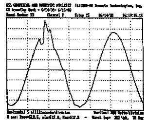 Dranetz Case Study - Utility Power Factor